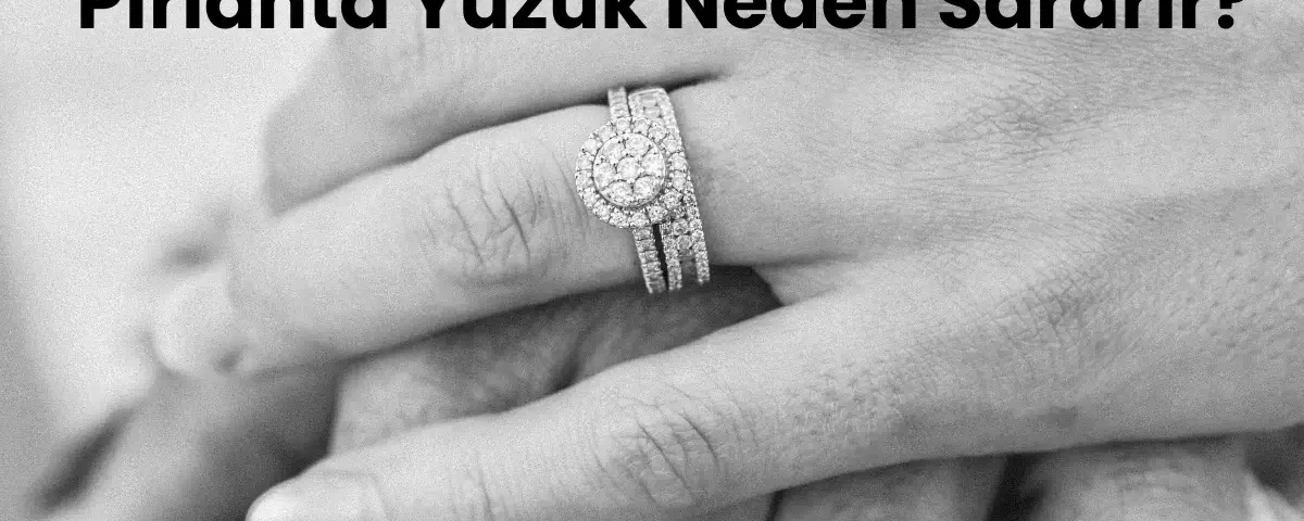 Pırlanta yüzük neden sararır?