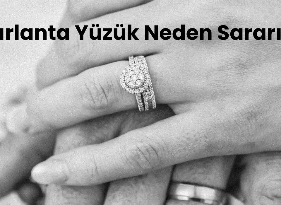 Pırlanta yüzük neden sararır?